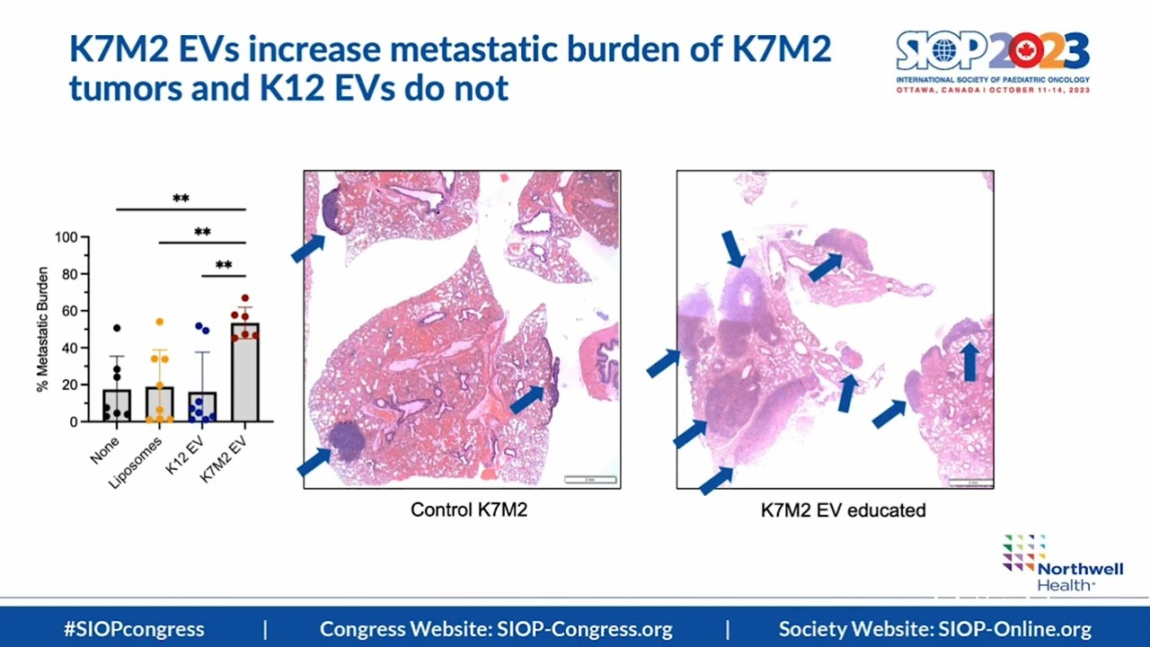 Bailey Roberts' Presentation at the Best of the Best in Pediatric Surgery 2024!