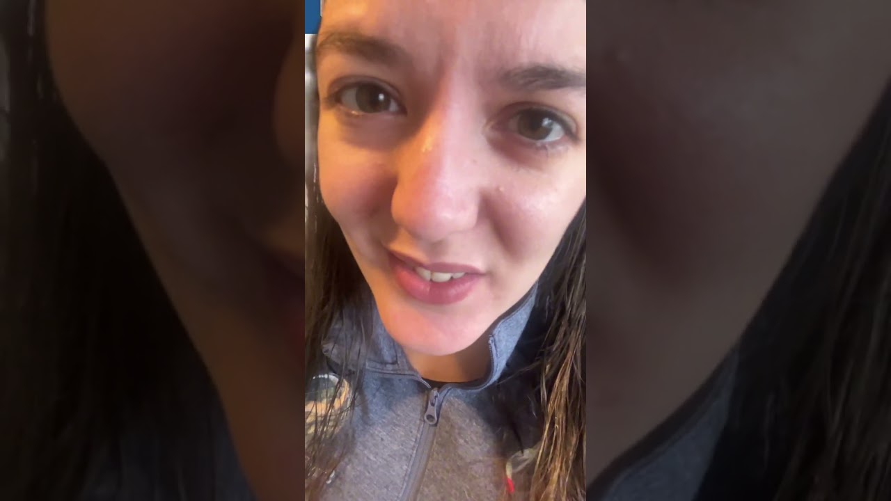 La colecistectomía al ingreso por colecistitis aguda reduce las tasas de reingreso a 30 días