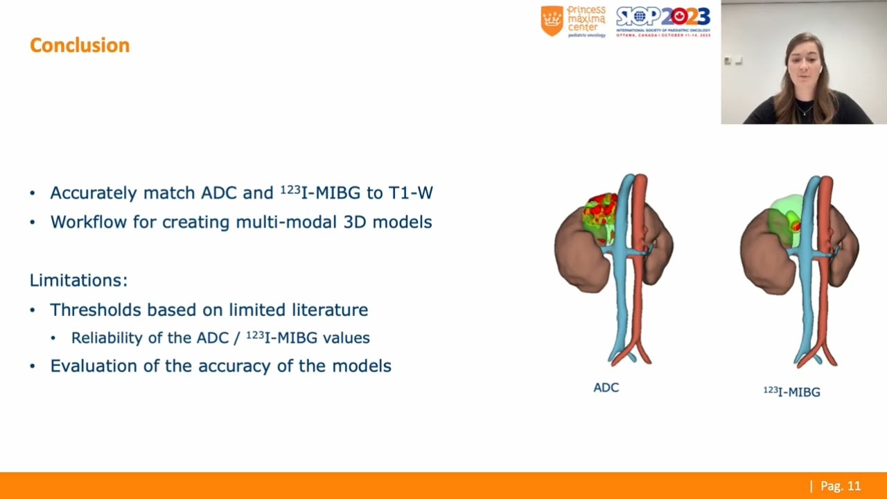 Dominique Simons’ Presentation at the Best of the Best in Pediatric Surgery 2024